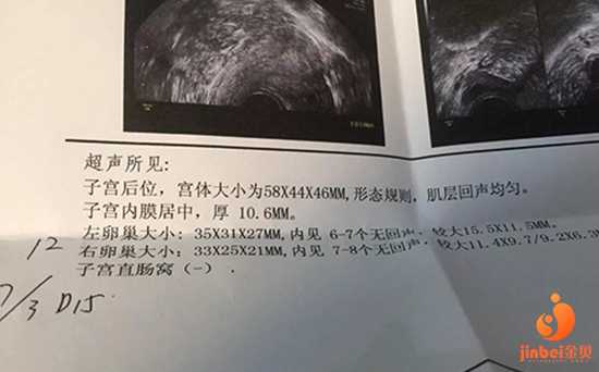 吉水县第三方助孕公司_吉水县哪个助孕机构最好_昆华医院试管婴儿收费明细，